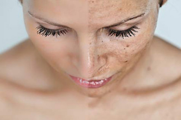 How to Flawlessly Cover Up Skin Imperfections