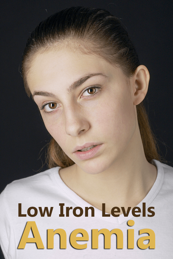 Low Iron Levels - Iron Deficiency Anemia