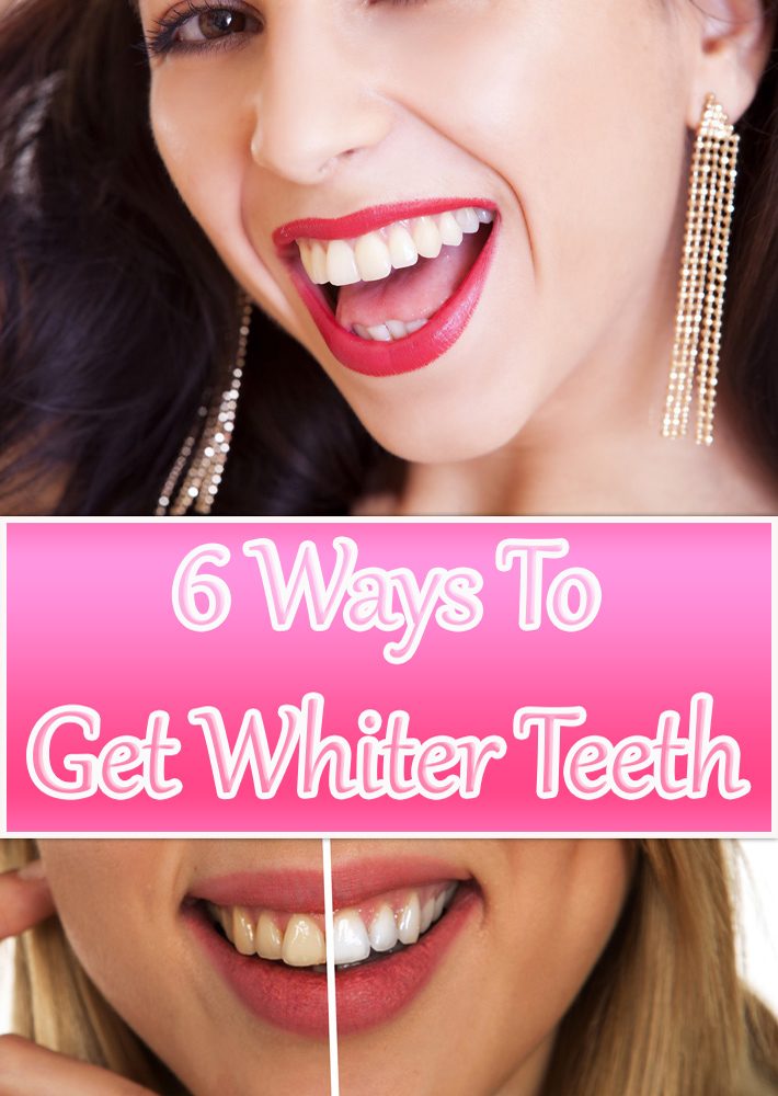 6 Ways To Get Whiter Teeth