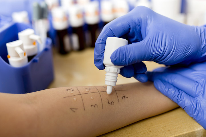 Allergy Testing – What Method is The Best?