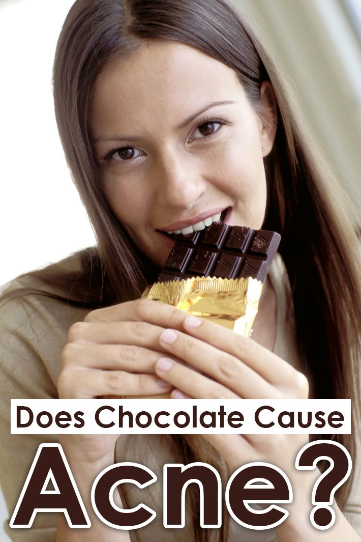 Does Chocolate Cause Acne?