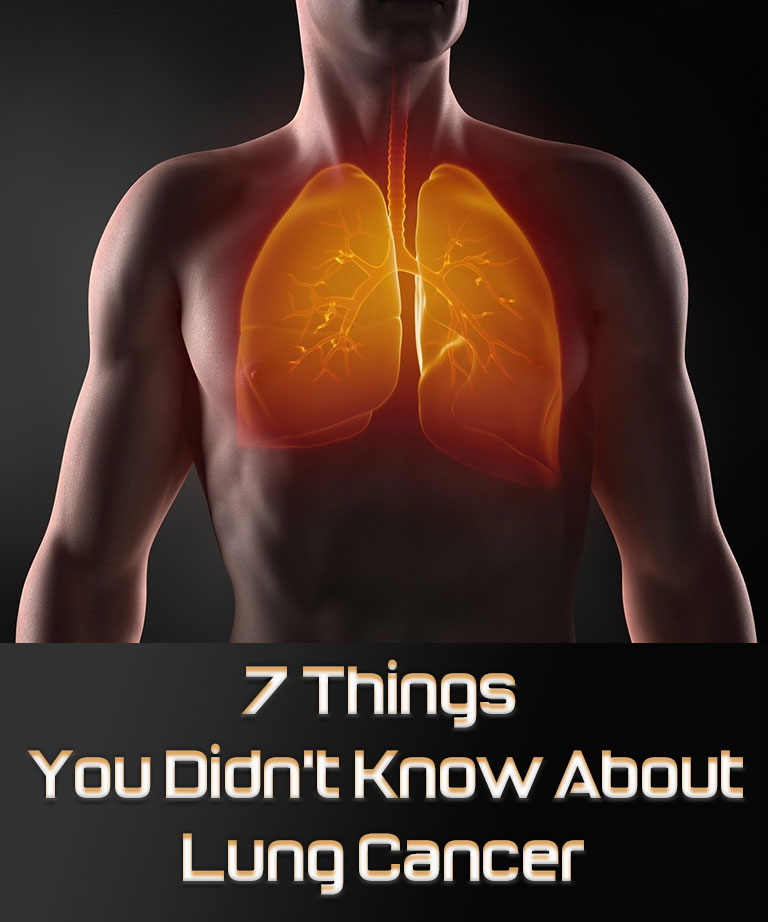 7 Things You Didn't Know About Lung Cancer