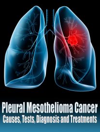 Pleural Mesothelioma Cancer - Causes, Tests, Diagnosis and Treatments